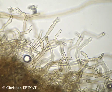 Coltricia perennis récolté sur la commune de Barre des Cévennes (48) - Microscopie de détail de cuticule